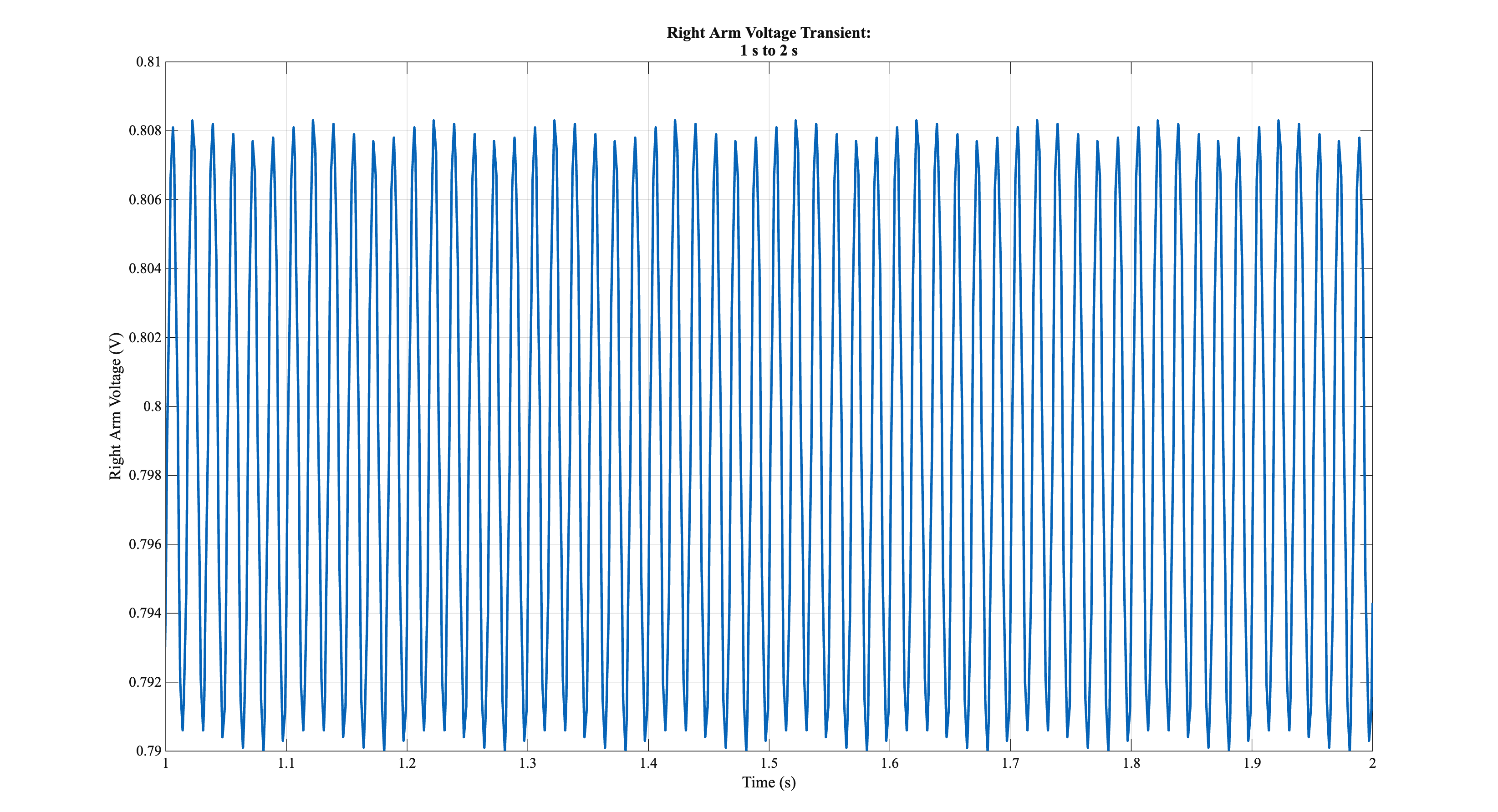 Right arm transient voltage after the electrodes